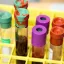 Vials of blood in a rack. Credit: National Cancer Institute, Unsplash